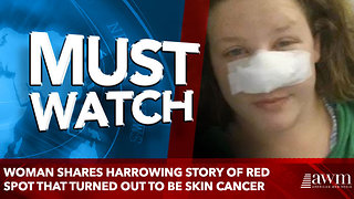 Woman shares harrowing story of red spot that turned out to be skin cancer