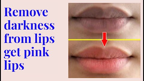 Mysterious HOME REMEDY TO GET PINK LIPS