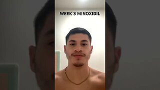 WEEK 3 USING MINOXIDIL #shorts