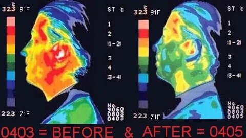 Thermographic images of a head lacking citations, sources, or references & no explanation of color