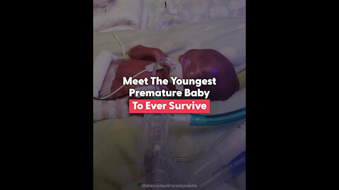 Meet The Youngest Premature Baby To Ever Survive
