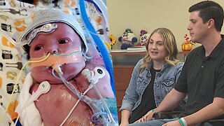 'He's a fighter': Rifle baby with rare heart condition facing new challenges