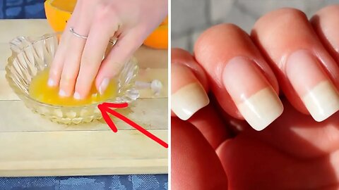 How to Make Your Nails Grow Faster and Longer