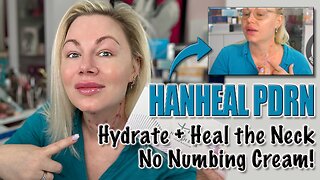 Hydrate & Heal the Neck Tissue with Hanheal PDRN, No Numbing Cream! AceCosm | Code Jessica10 Saves