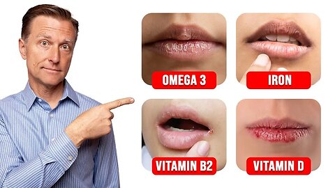 5 Things Your LIPS Can Tell You about Your Nutritional State