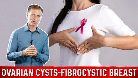 How to Remove Ovarian Cysts & Treat Fibrocystic Breast with this ONE Mineral! – Dr.Berg