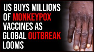 US Buys Millions Of MONKEYPOX Vaccines Amid Global Outbreak