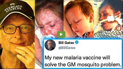 Bill Gates Admits His GM Mosquitoes Are Causing Deadly Malaria Outbreak in U.S