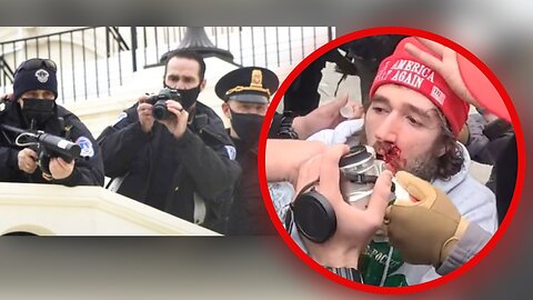 Capitol Police Shoot Another Protester In The Face on Jan. 6 Then Refuse Aid