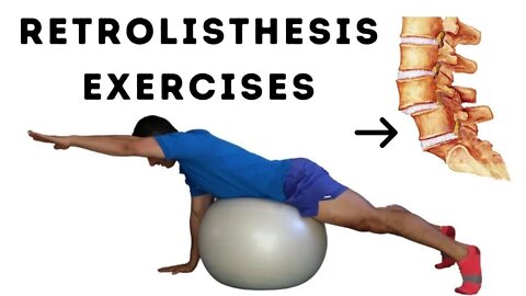 Retrolisthesis Exercises for Stronger Core