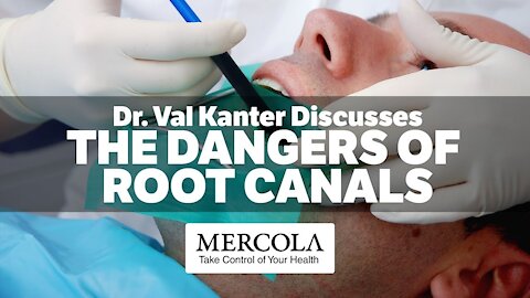 Root Canal Dangers- Interview with Dr. Val Kanter and Dr. Mercola