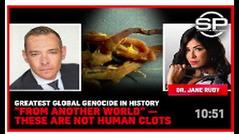 Greatest Global Genocide In History "From Another World" - These Are Not Human Clots