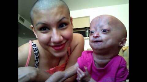 Twins - Adalia Rose (Official)