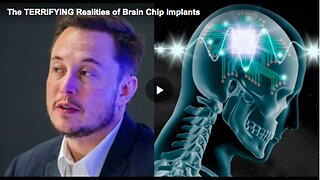 Terrifying realities of brain chip implants