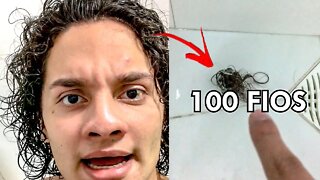 QUEDAS CAPILARES EM CABELO MASCULINO