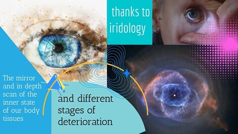 The mirror of the inner state of our body tissues and stages of deterioration thanks to iridology