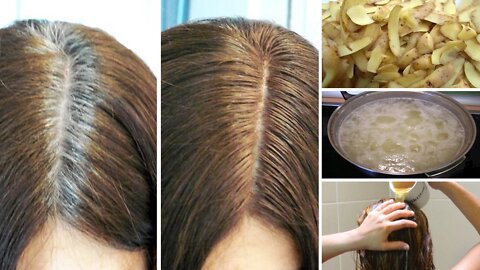 Get Rid of Gray Hair Naturally With Potato Skins