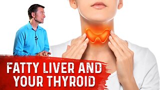 Why Can A Fatty Liver Slow Your Thyroid (Hypothyroid)? – Dr. Berg