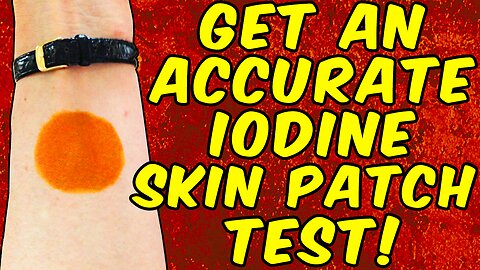 How To Get An Accurate Iodine Skin Patch Test Result!