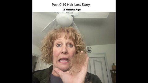 Post-COVID Hair Loss