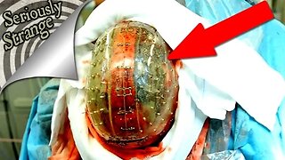 3 Unbelievable Medical Breakthroughs | SERIOUSLY STRANGE #42