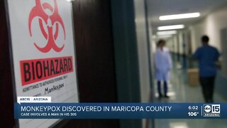 First probable case of monkeypox reported in Arizona