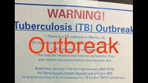 Potential Outbreak in Middle Tennessee | Tuberculosis and 3rd World Diseases