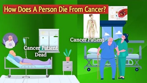 How Does A Person Die From Cancer? Animation by Behealthy Team.