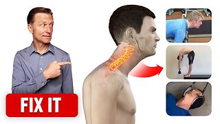 Correct Forward Head Posture with 3 Things - Dr. Berg