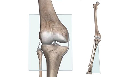 Osteoarthritis of the knee part 1 knee anatomy -human body animated anatomy