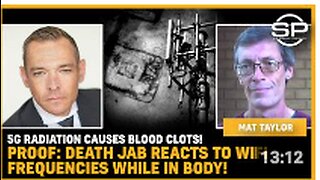 5G Radiation Causes BLOOD CLOTS! PROOF: Death Jab REACTS To WiFi Frequencies While In BODY!