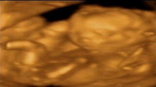 Noah 19 Weeks in Womb Ultrasound 3D Video