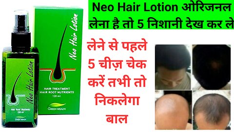 Neo Hair Lotion original hou to know