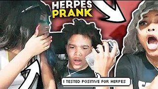 I GAVE YOU HERPES PRANK ON OBEYTONI 😱🤮 CRAZY REACTION **MUST WATCH**