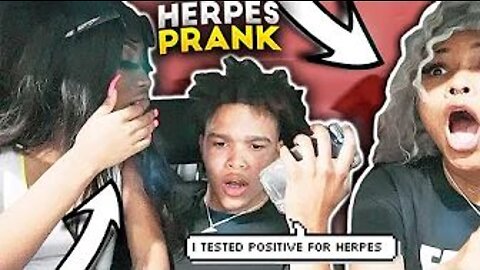 I GAVE YOU HERPES PRANK ON OBEYTONI 😱🤮 CRAZY REACTION **MUST WATCH**