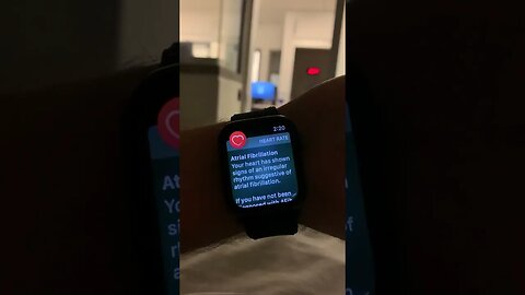 Apple Watch Is Useful tiktok sdeeyre