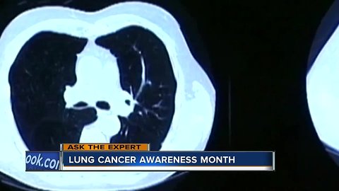 Ask the Expert: Lung Cancer Awareness Month