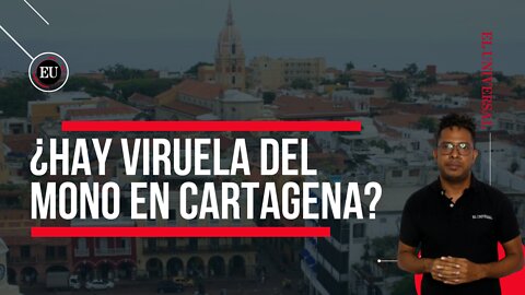 Dadis revela resultados de pruebas de viruela del mono en Cartagena