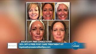 Remove Wrinkles with Ageless Expressions