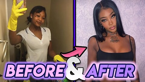 Summer Walker | Before & After | Plastic Surgery Transformation 2020