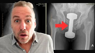 Shocking Emergency Room Stories | Dr. Rob Orman talks Rectal Foreign Bodies