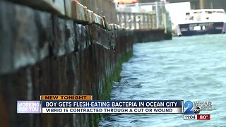 Boy gets flesh-eating bacteria in Ocean City