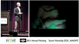 Stuart Nunnally DDs. discusses Trigeminal Neuralgia IAOMT 2011 Las Vegas