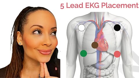 Hack How to Remember 5 lead ECG Placement 5 LEAD ECG RHYME