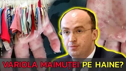 ”VIRUSUL SE TRANSMITE PE HAINE?”. ANUNȚ DESPRE VARIOLA MAIMUȚEI