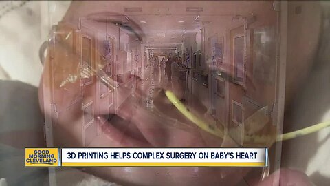 3-D print helps doctors at the Cleveland Clinic perform first-ever ventricle switch on 9-month-old's heart