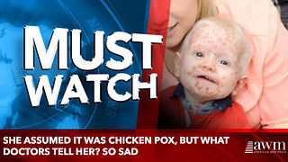 She Assumed It Was Chicken Pox, But What Doctors Tell Her? SO SAD