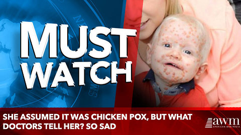 She Assumed It Was Chicken Pox, But What Doctors Tell Her? SO SAD