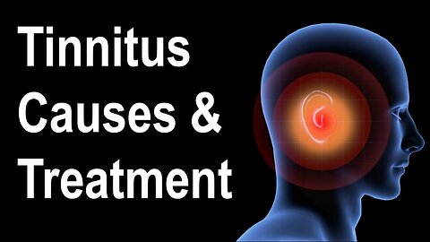 " What is Tinnitus? Causes ” | 3 easy steps | Become immune to tinnitus just like 68% of people
