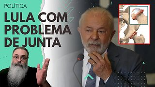 LULA chora de DOR e PRECISA ser ENVIADO as PRESSAS para o HOSPITAL, INFELIZMENTE não é DOENÇA FATAL